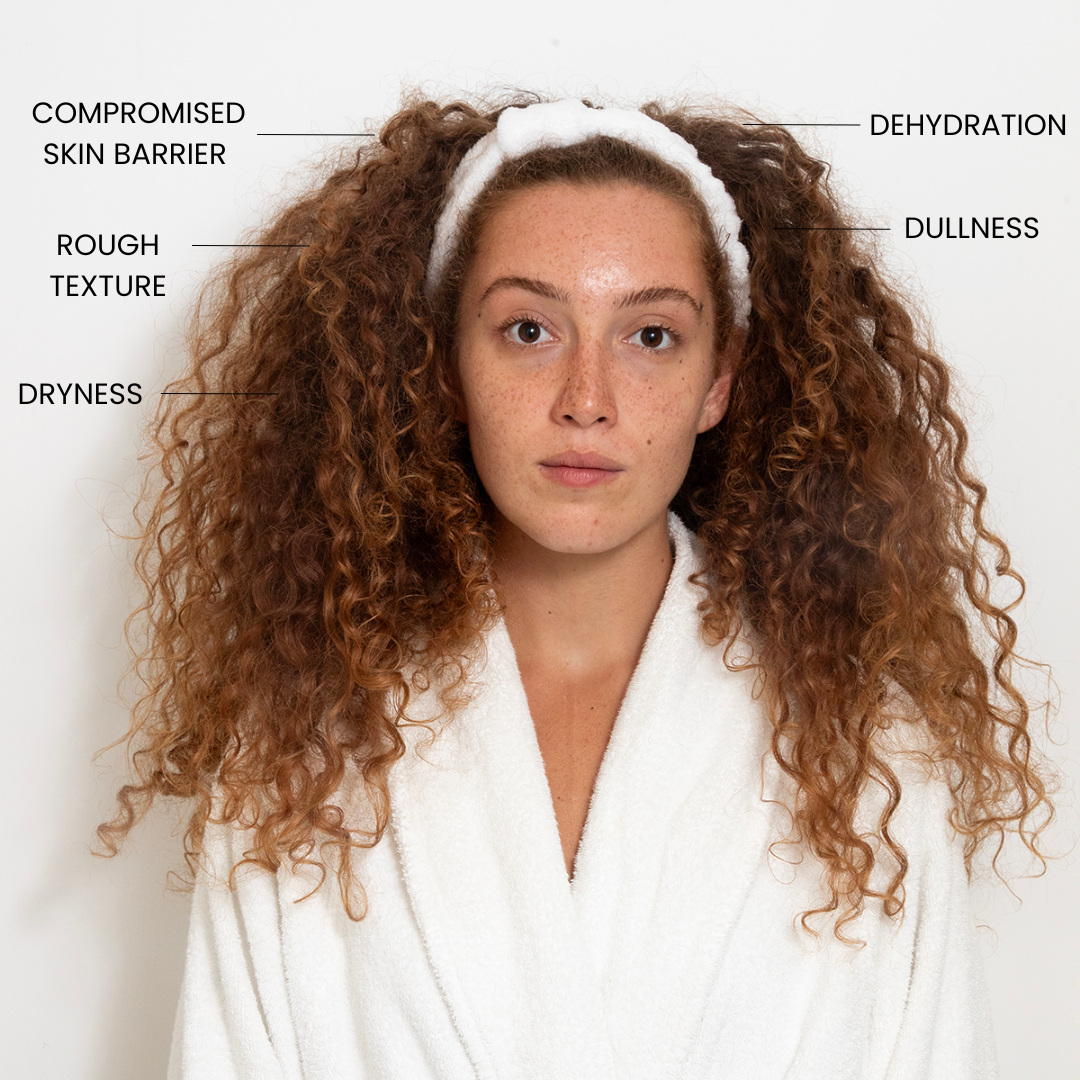 Advanced Hydrating Moisturizer list of skin concern: Dehydration, Dryness, Compromised skin barrier, Redness and irritation, Rough texture, Dullness