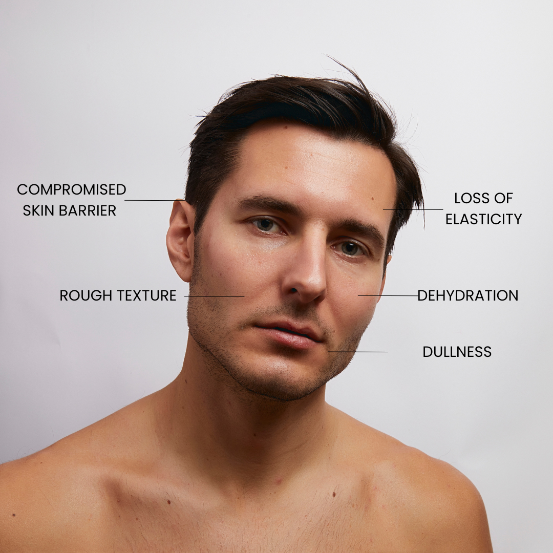 Skin concerns that Kleem Hyaluronic Acid Serum solves like: Dehydration, Loss of elasticity, Compromised skin barrier, Rough texture, Dullness