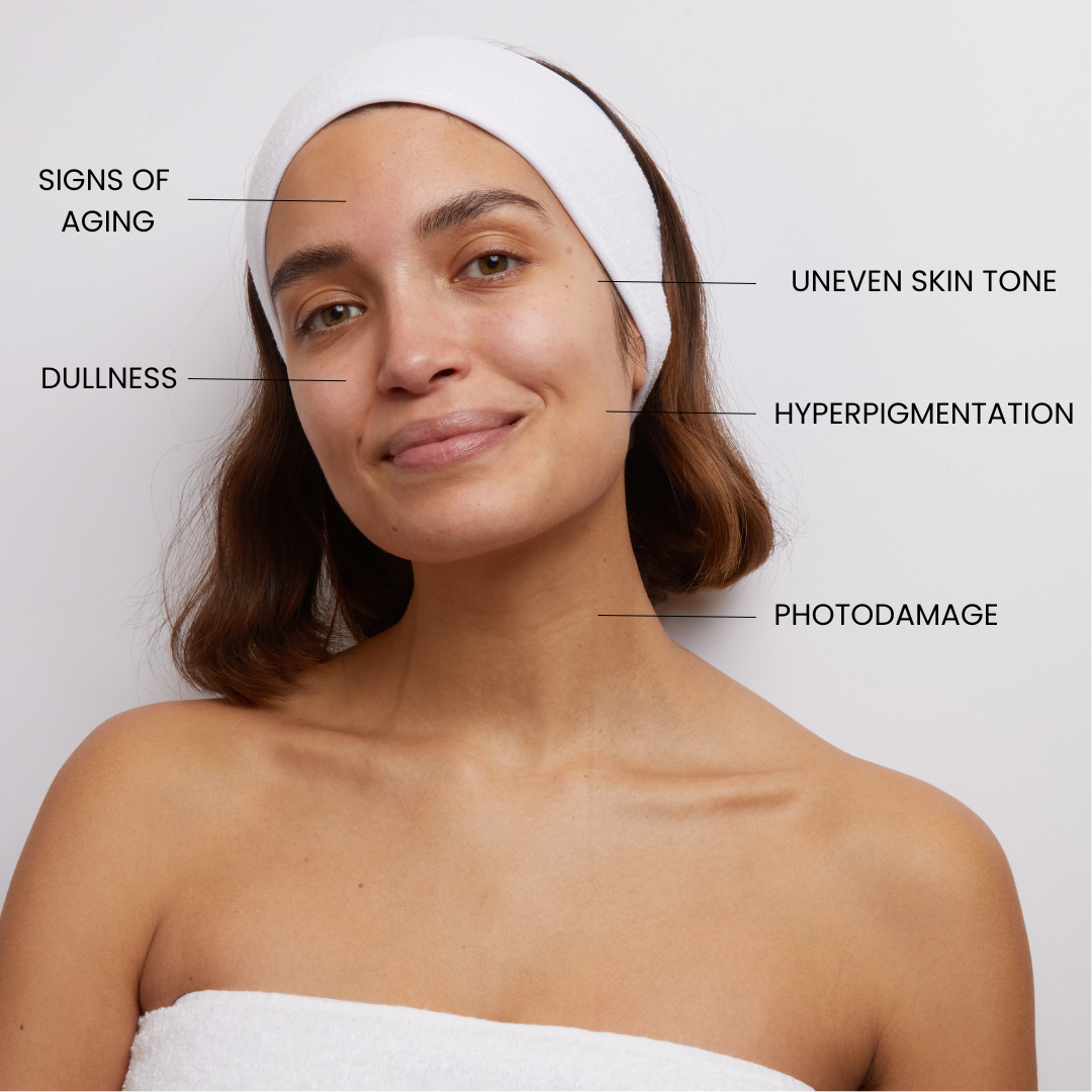 Skin concerns that Kleem Organics Vitamin c serum solves like: Hyperpigmentation

Dullness

Uneven skin tone, rough texture

Loss of elasticity