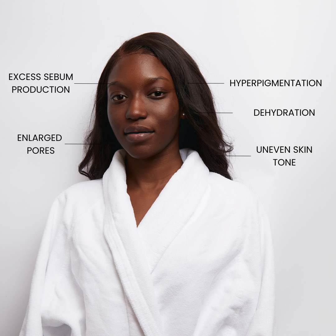 Skin concerns that Kleem Niacinamide Booster solves like: Hyperpigmentation, Enlarged pores, Uneven skin tone, Excess sebum production, Dehydration
