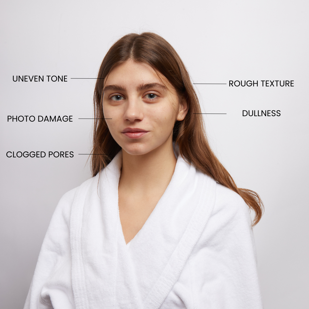 Skin concerns that Kleem Vitamin C Face Cleanser solves like: Rough texture, Dullness, Uneven tone, Phot damage, Clogged pores
